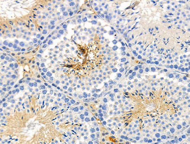 Phospho-eIF2 beta (Ser67) Antibody in Immunohistochemistry (Paraffin) (IHC (P))