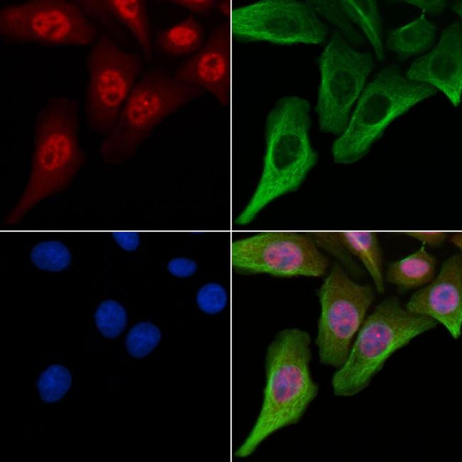 Phospho-XRCC1 (Thr284) Antibody in Immunocytochemistry (ICC/IF)