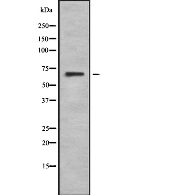 GPR50 Antibody in Western Blot (WB)