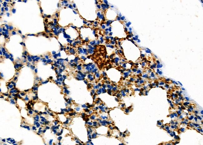 KCNE2 Antibody in Immunohistochemistry (Paraffin) (IHC (P))