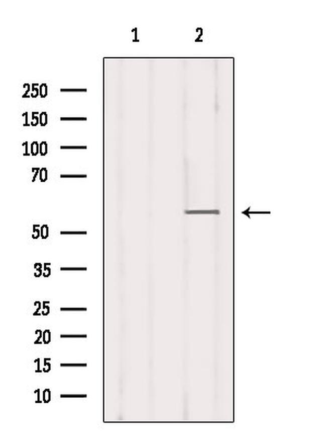 B7-H3 Antibody in Western Blot (WB)