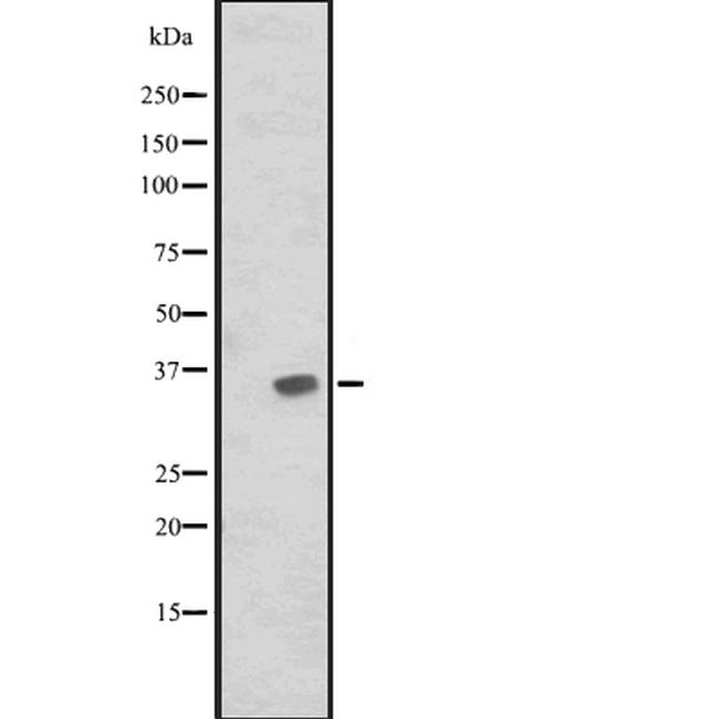 JAM2 Antibody in Western Blot (WB)