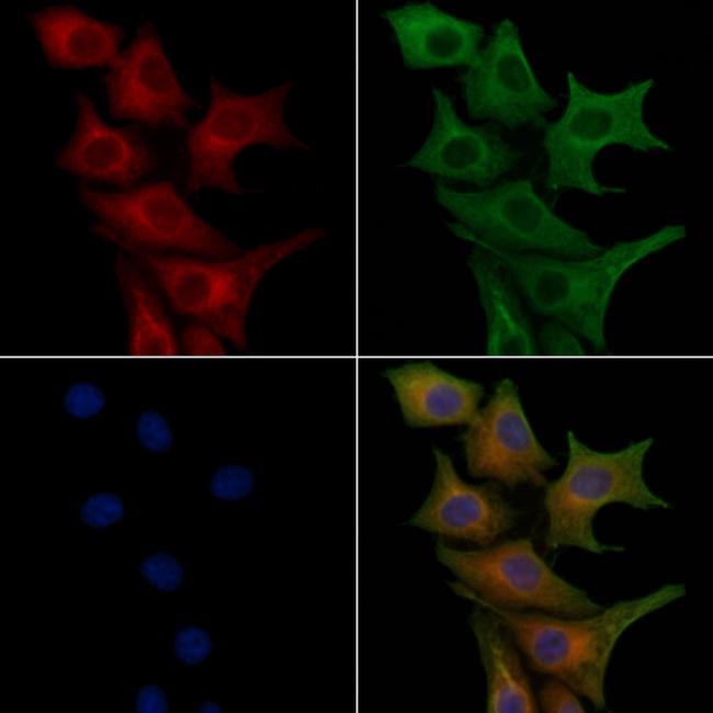 GPR30 Antibody in Immunocytochemistry (ICC/IF)