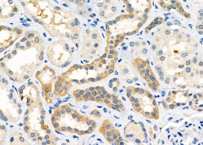 OXGR1 Antibody in Immunohistochemistry (Paraffin) (IHC (P))