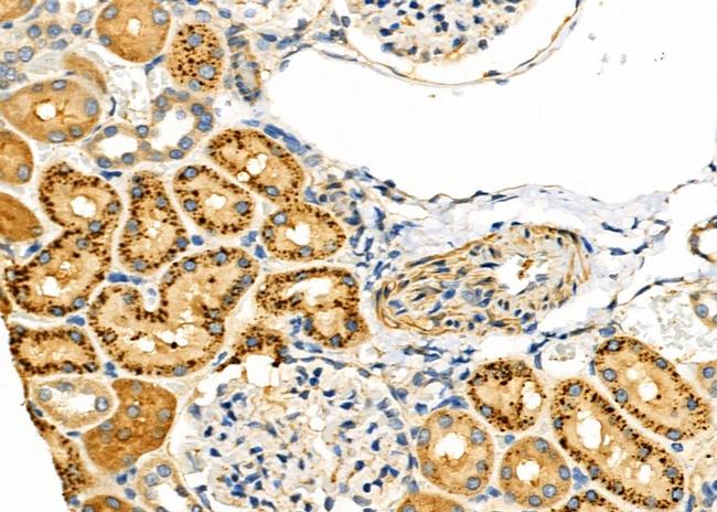 GPR89A Antibody in Immunohistochemistry (Paraffin) (IHC (P))