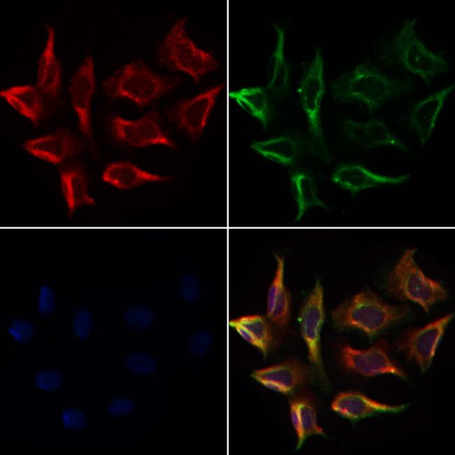 FGR Antibody in Immunocytochemistry (ICC/IF)