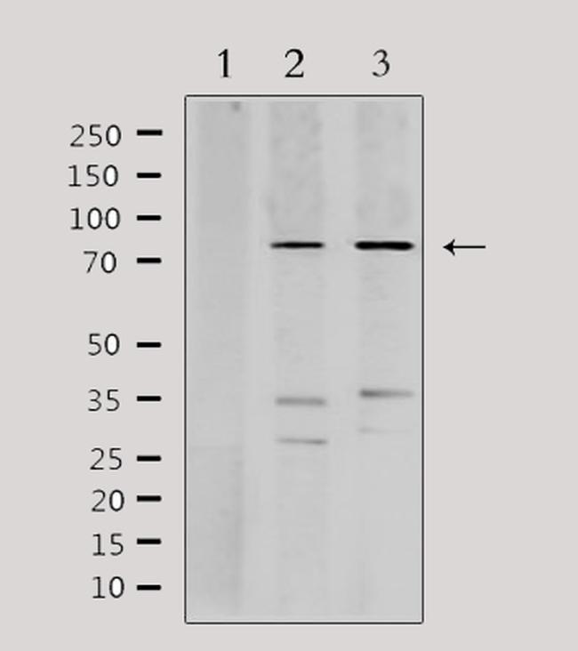 PFKP Antibody in Western Blot (WB)