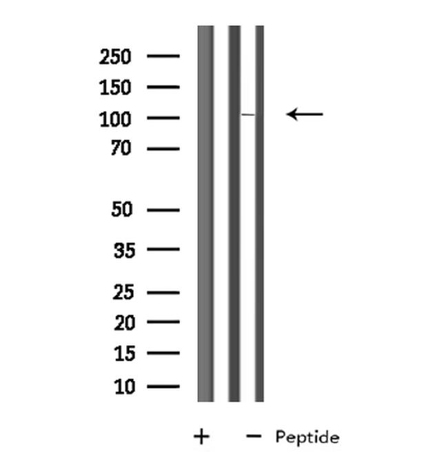 SP100 Antibody in Western Blot (WB)