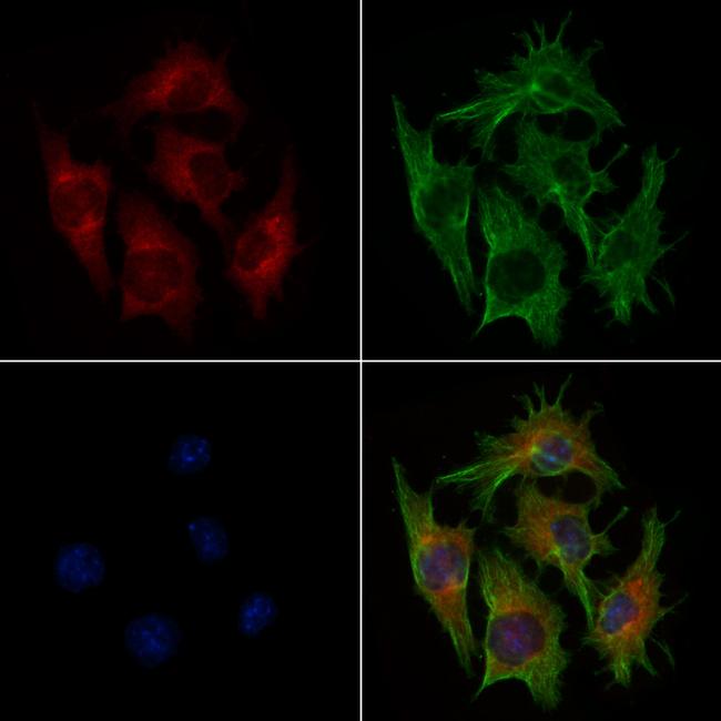 PYCARD Antibody in Immunocytochemistry (ICC/IF)