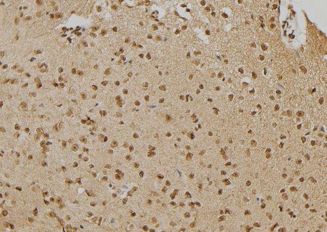 PTPN22 Antibody in Immunohistochemistry (Paraffin) (IHC (P))