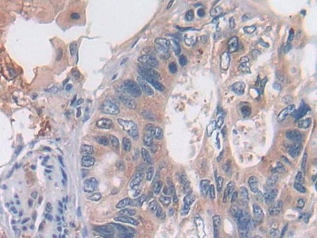 OAS2 Antibody in Immunohistochemistry (Paraffin) (IHC (P))