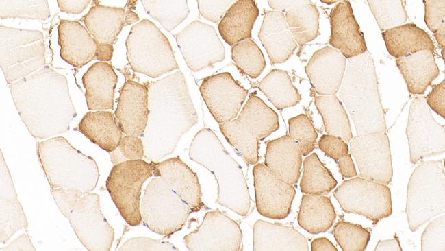 NT5M Antibody in Immunohistochemistry (Paraffin) (IHC (P))