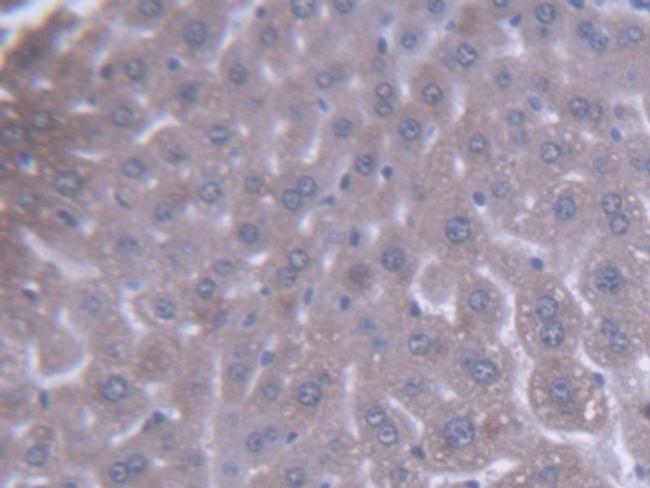 ACAA1 Antibody in Immunohistochemistry (Paraffin) (IHC (P))