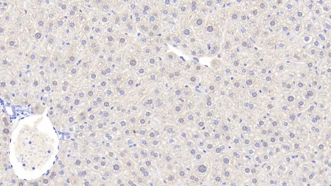 Alcohol Dehydrogenase 1A Antibody in Immunohistochemistry (Paraffin) (IHC (P))