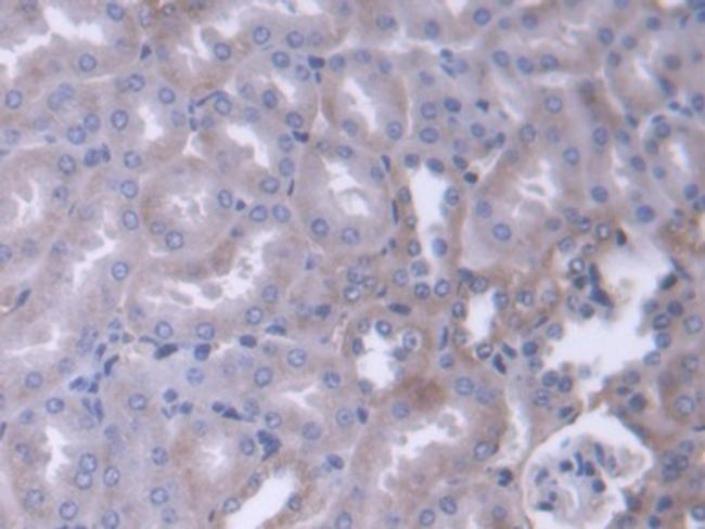 alpha Adducin Antibody in Immunohistochemistry (Paraffin) (IHC (P))