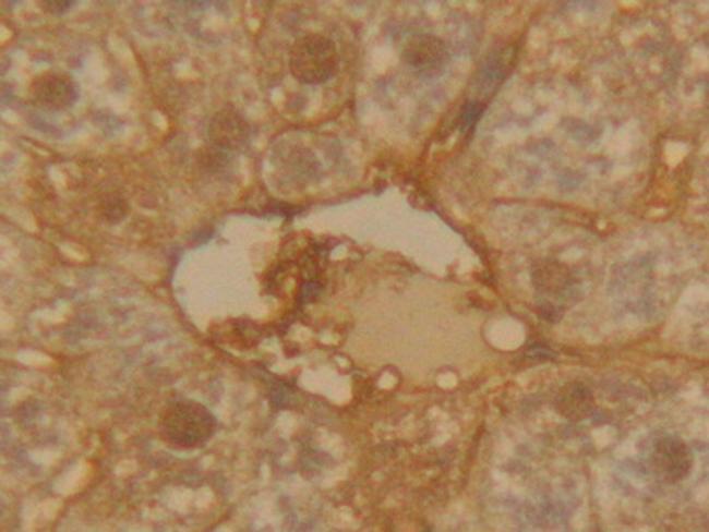 alpha-1 Antitrypsin Antibody in Immunohistochemistry (Paraffin) (IHC (P))