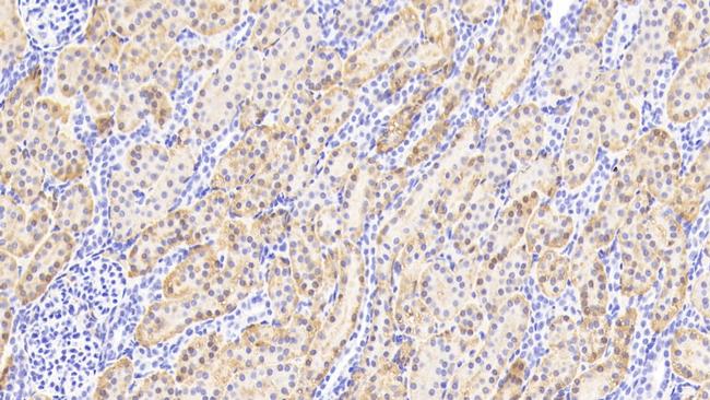 Aminoacylase Antibody in Immunohistochemistry (Paraffin) (IHC (P))