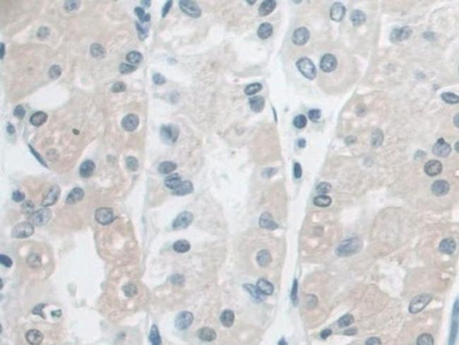 AUP1 Antibody in Immunohistochemistry (Paraffin) (IHC (P))