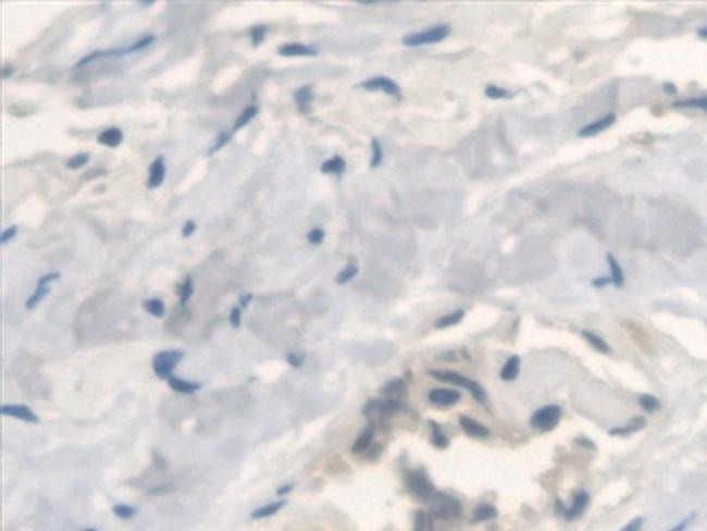 ANTXR2 Antibody in Immunohistochemistry (Paraffin) (IHC (P))