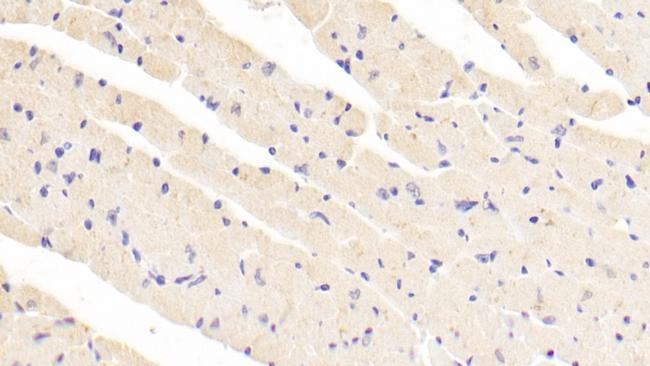 Artemin Antibody in Immunohistochemistry (Paraffin) (IHC (P))