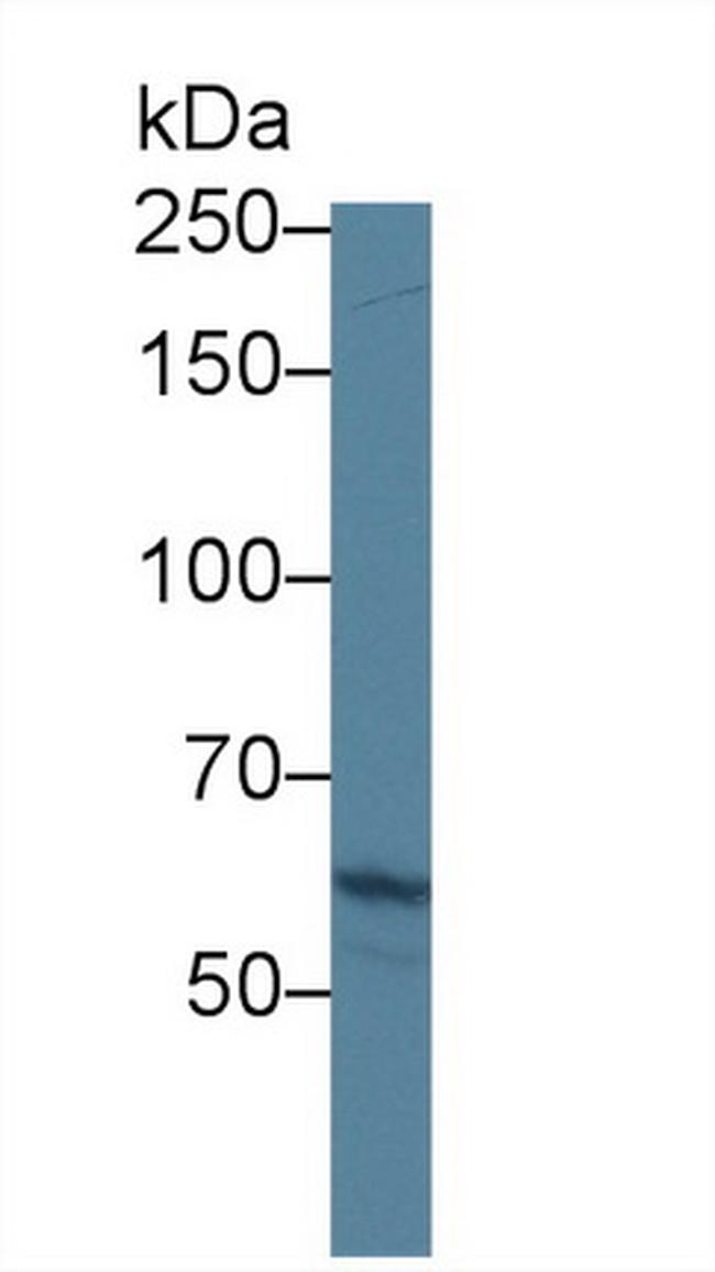 ABCA3 Antibody in Western Blot (WB)