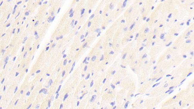 ABCD2 Antibody in Immunohistochemistry (Paraffin) (IHC (P))