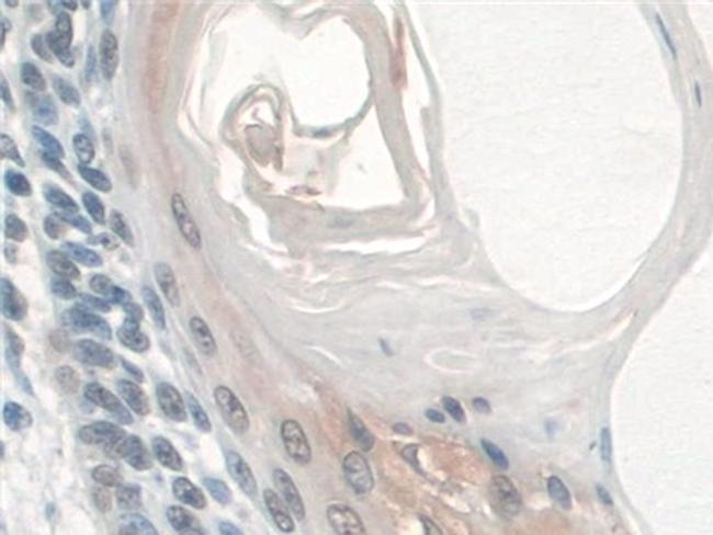 BANF1 Antibody in Immunohistochemistry (Paraffin) (IHC (P))