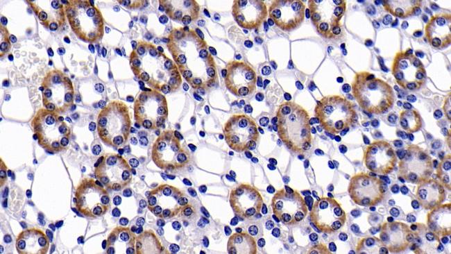 Bcl-2 Antibody in Immunohistochemistry (Paraffin) (IHC (P))