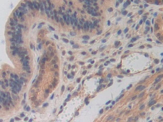 CDH16 Antibody in Immunohistochemistry (Paraffin) (IHC (P))