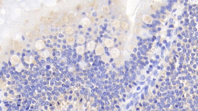 Caspase 2 Antibody in Immunohistochemistry (Paraffin) (IHC (P))