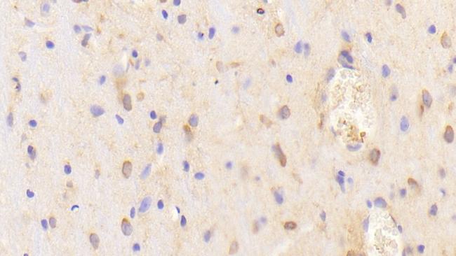 CHN2 Antibody in Immunohistochemistry (Paraffin) (IHC (P))