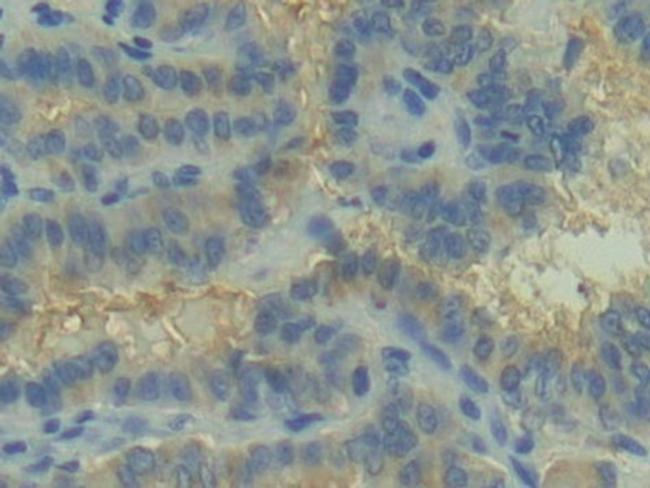 C2 Antibody in Immunohistochemistry (Paraffin) (IHC (P))