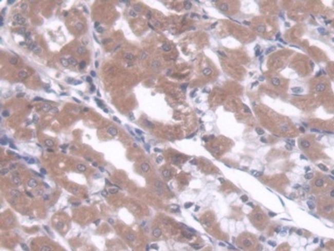 CBF beta Antibody in Immunohistochemistry (Paraffin) (IHC (P))