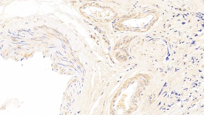 CDK4 Antibody in Immunohistochemistry (Paraffin) (IHC (P))