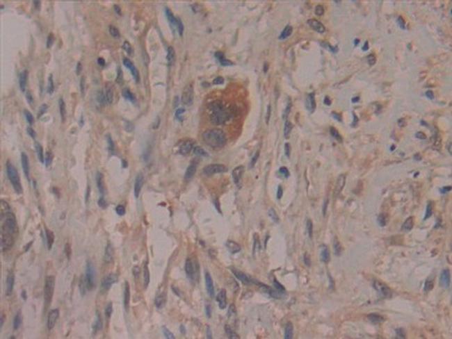 COX2 Antibody in Immunohistochemistry (Paraffin) (IHC (P))