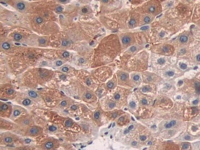 CYP26A1 Antibody in Immunohistochemistry (Paraffin) (IHC (P))