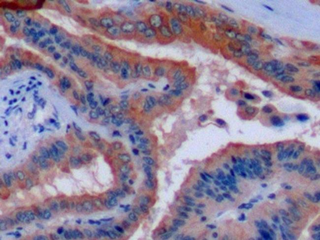 Cytokeratin 8 Antibody in Immunohistochemistry (Paraffin) (IHC (P))