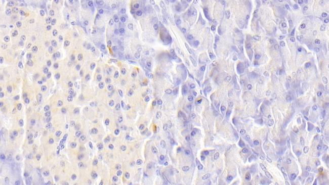 TRAIL-R2 (DR5) Antibody in Immunohistochemistry (Paraffin) (IHC (P))