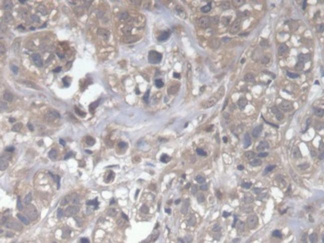 DOCK4 Antibody in Immunohistochemistry (Paraffin) (IHC (P))