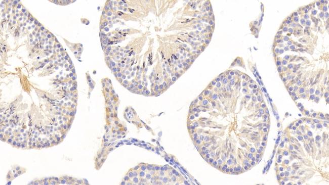 NSE Antibody in Immunohistochemistry (Paraffin) (IHC (P))