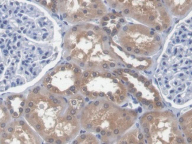 EEF1A1 Antibody in Immunohistochemistry (Paraffin) (IHC (P))