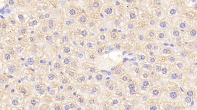 eIF2d Antibody in Immunohistochemistry (Paraffin) (IHC (P))