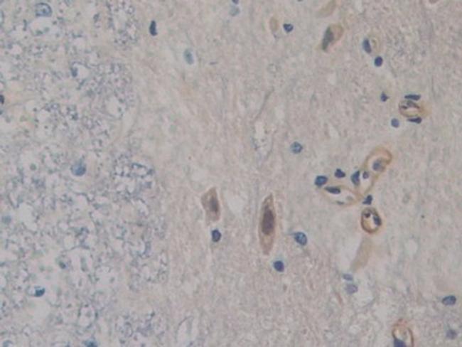 FABP9 Antibody in Immunohistochemistry (Paraffin) (IHC (P))