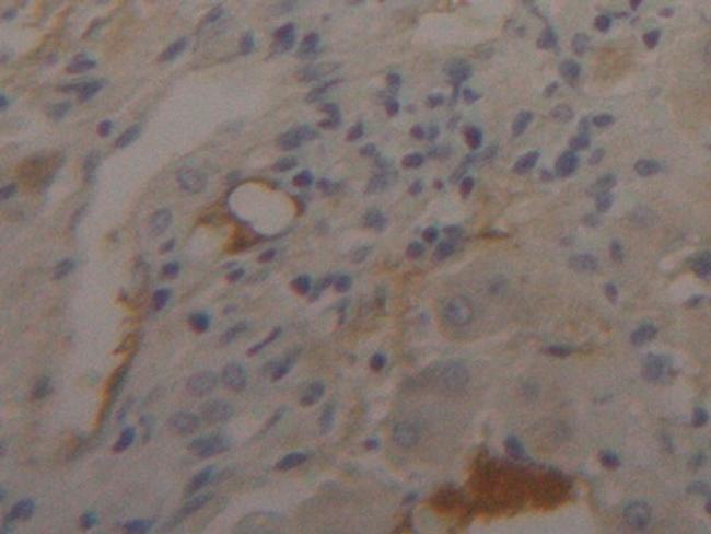 Fibrinogen Beta Chain Antibody in Immunohistochemistry (Paraffin) (IHC (P))