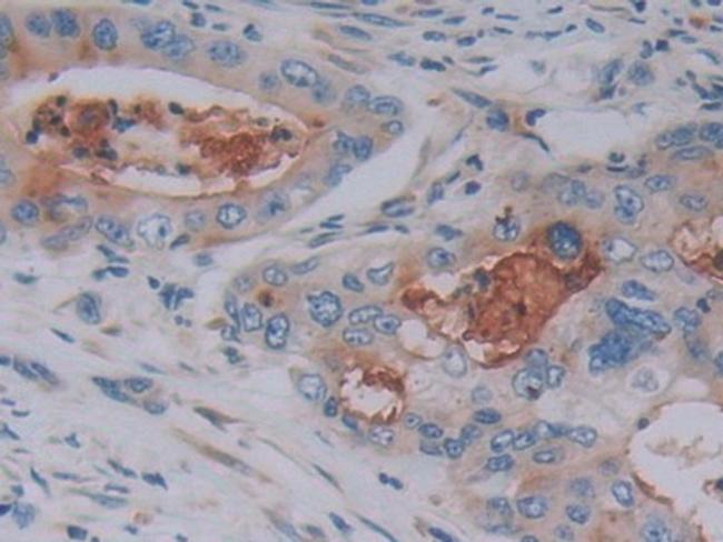 FKBP7 Antibody in Immunohistochemistry (Paraffin) (IHC (P))