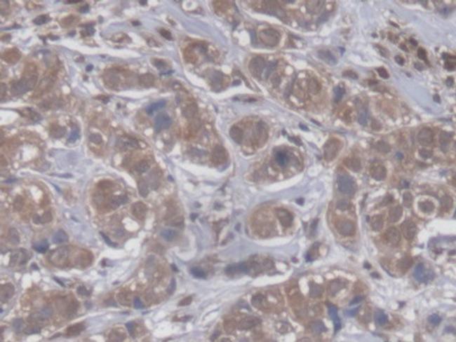 GBP4 Antibody in Immunohistochemistry (Paraffin) (IHC (P))