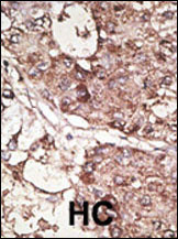 CD90 Antibody in Immunohistochemistry (Paraffin) (IHC (P))