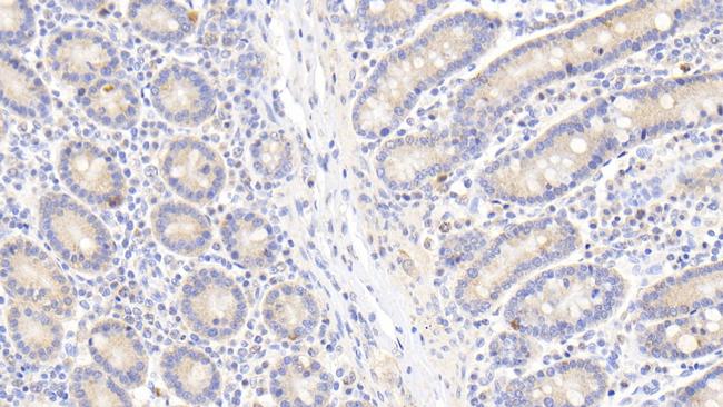 HSP60 Antibody in Immunohistochemistry (Paraffin) (IHC (P))