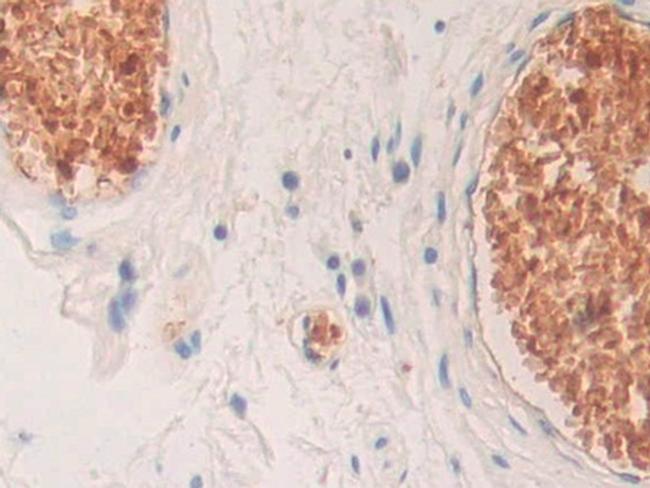 HBD Antibody in Immunohistochemistry (Paraffin) (IHC (P))