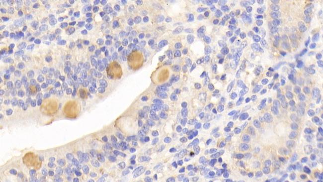 HFE2 Antibody in Immunohistochemistry (Paraffin) (IHC (P))